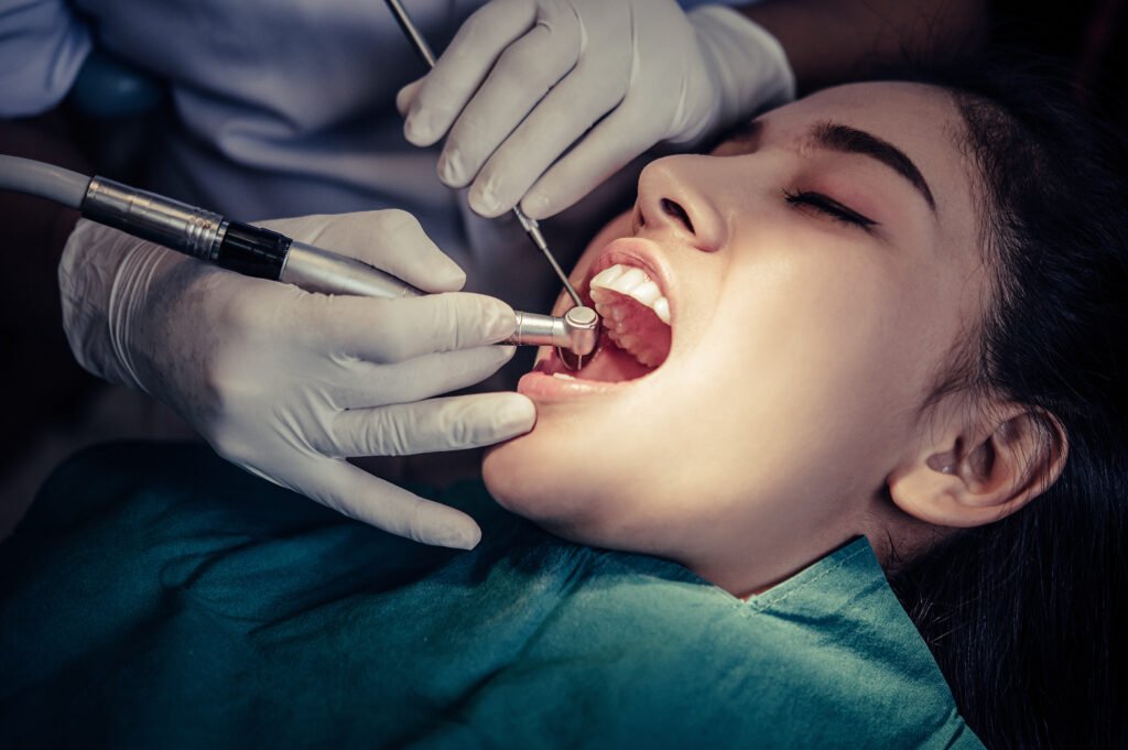tooth filling near me
