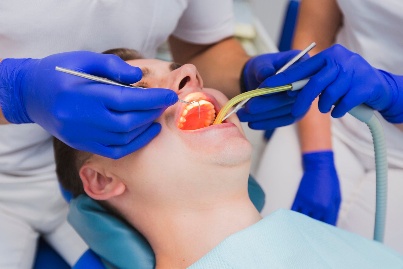Santa Monica tooth extraction