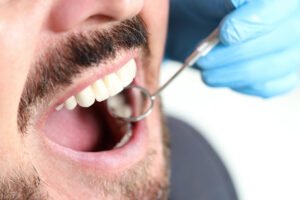 Dental Crowns dentist